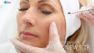 Everything you need to know about Botox restoration