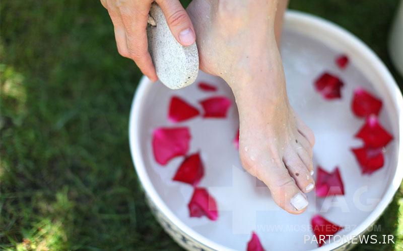 Treatment of cracked soles