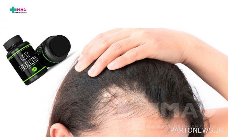 Does fat burning pill cause hair loss?