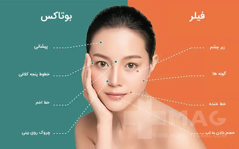 The difference between Botox and gel
