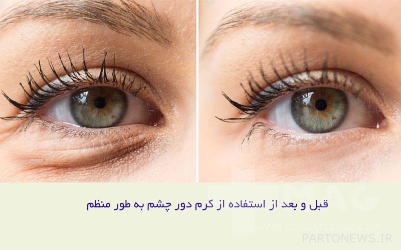 Picture before and after using eye cream