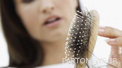 وز شدن موی خانم ها نشانه کمبود کدام ویتامین است؟