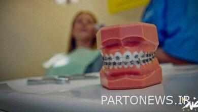 "Anti" goes to "tooth trade".
