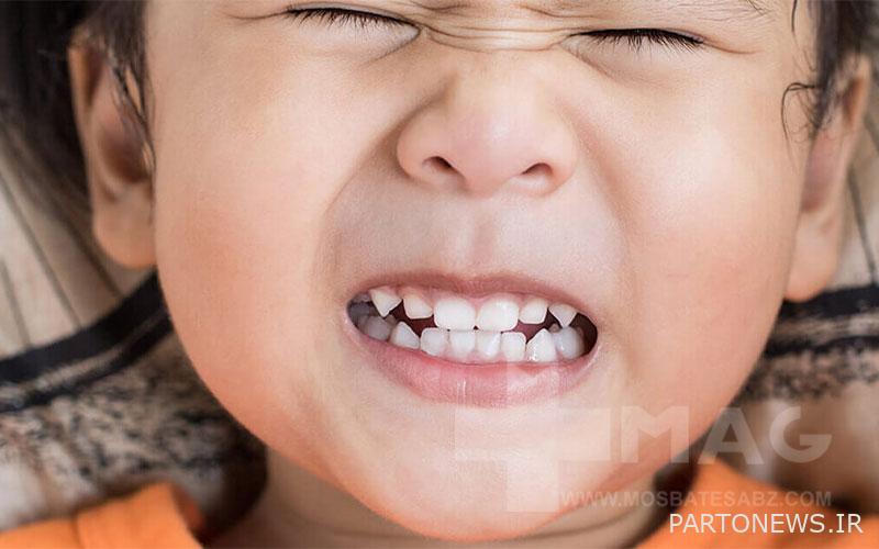 Grinding teeth of children in sleep