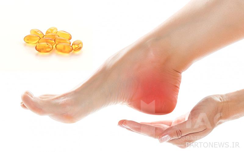 The effect of vitamin D deficiency on heel pain