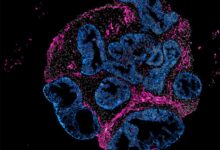 2DOrganoidSlice_greynuclei_pinksmoothmuslce_blueepithelium_